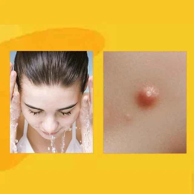 AQA™ TagRecede Bee Venom Treatment Spray