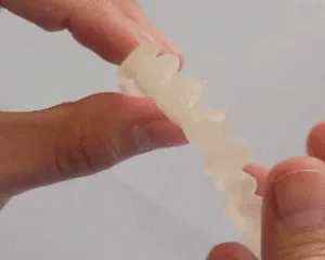 Adjustable Snap-On Dentures