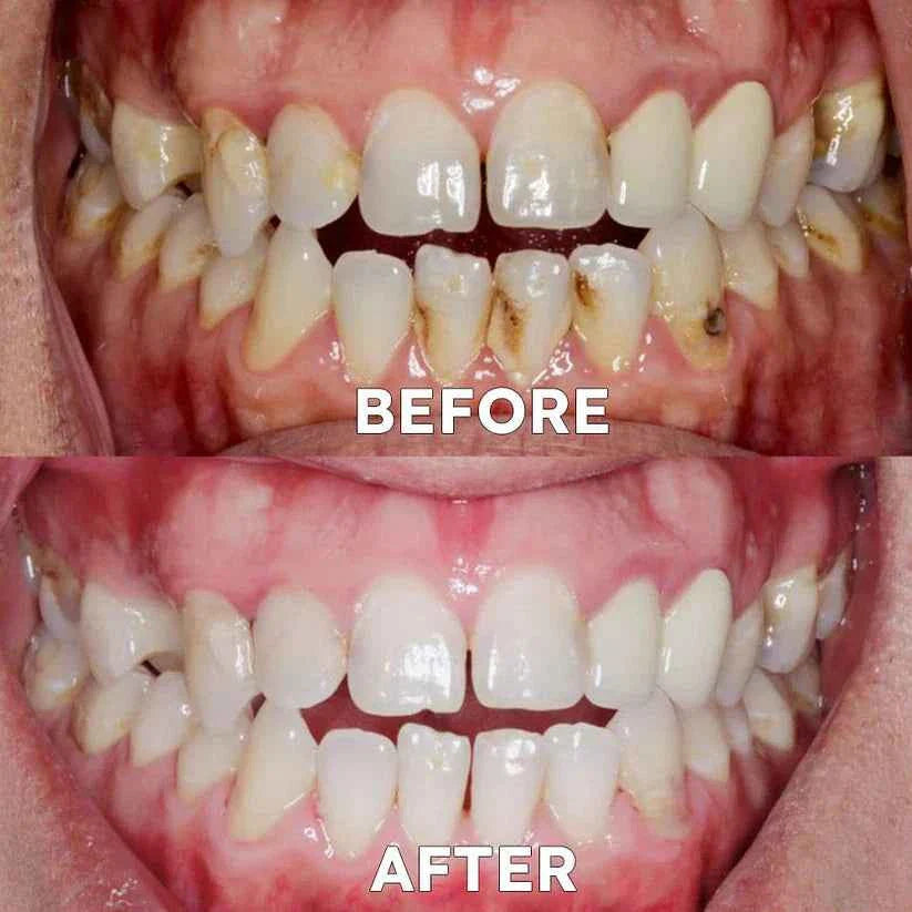 Ourlyard™ Tooth Powder