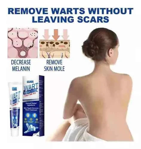 Instant Herbal Wart Remover Cream(100g)