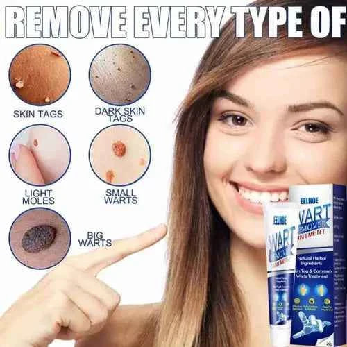 Instant Herbal Wart Remover Cream(100g)