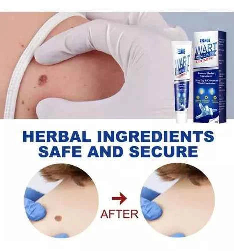 Instant Herbal Wart Remover Cream(100g)